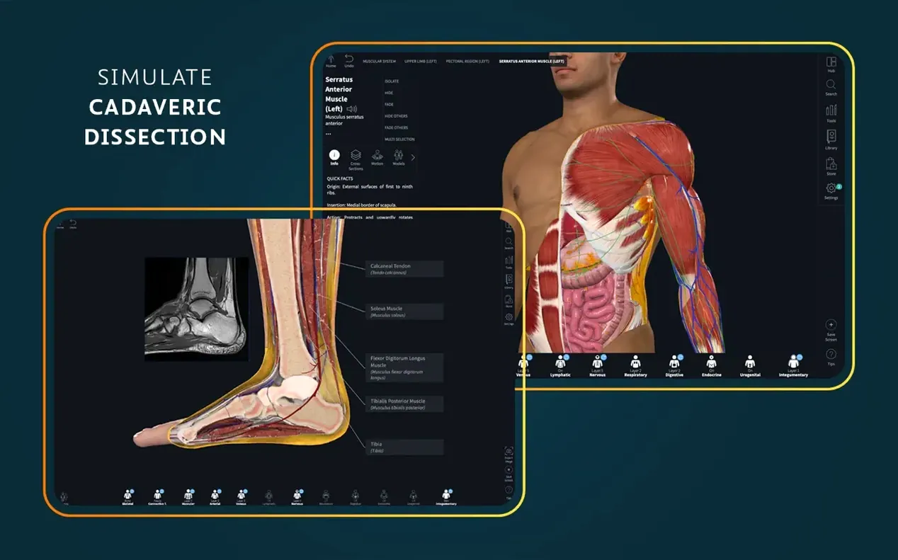 Complete Anatomy — glimpse 2 Complete Anatomy usage, image 2