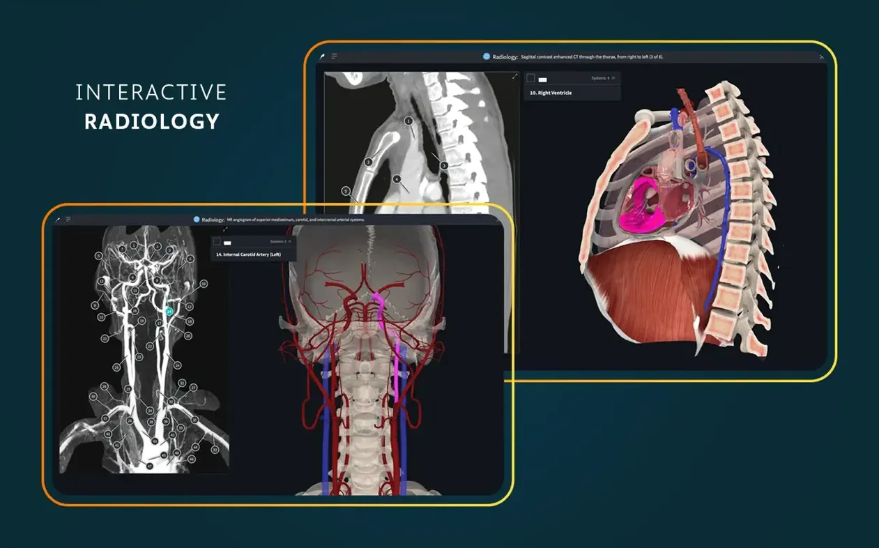 Complete Anatomy visual 7 Complete Anatomy close-up 7